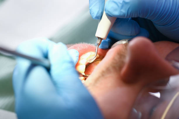 Best Emergency Denture Repair in Williston, ND